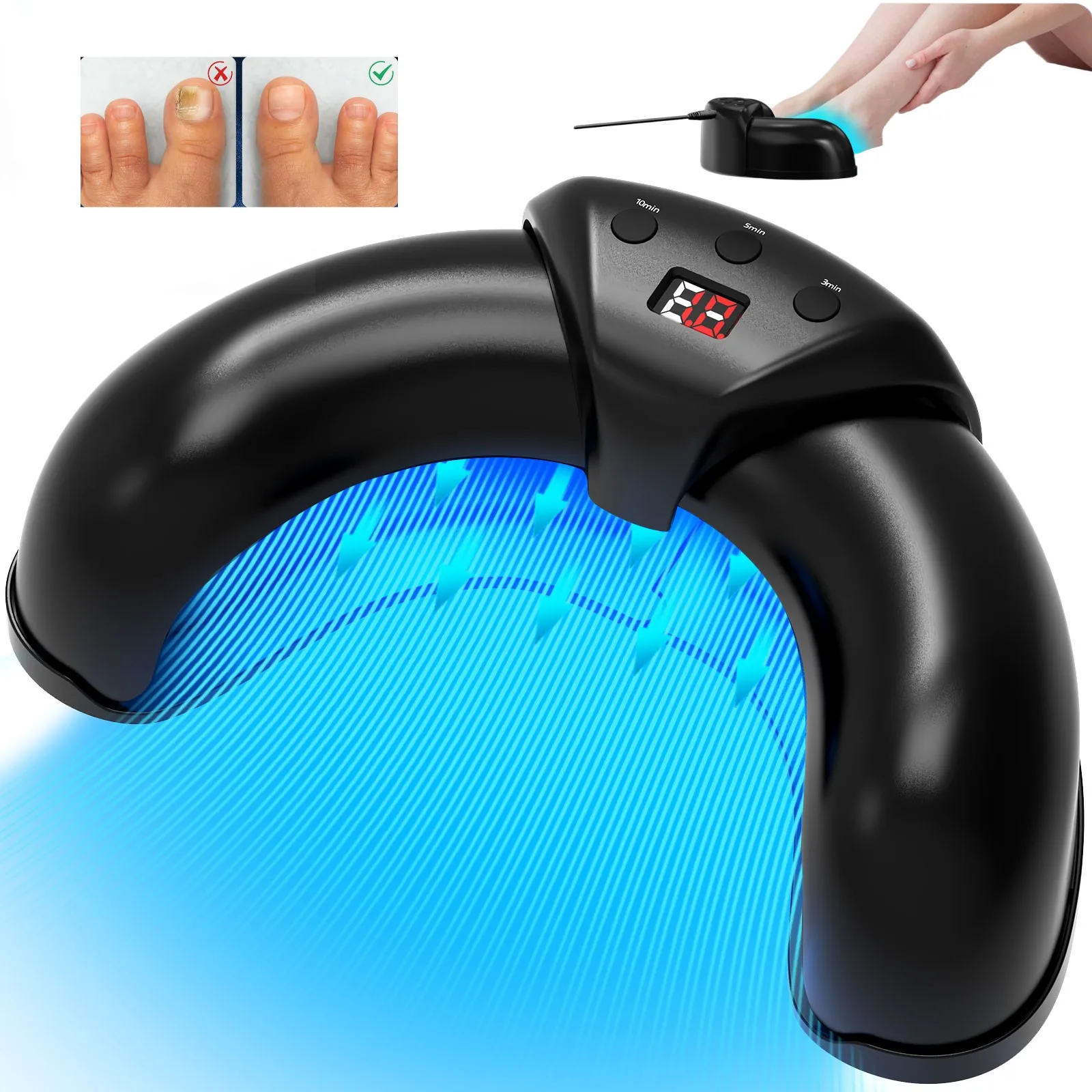 Nail Fungus Laser Device – Blue & Red Light Therapy for Damaged, Discolored Nails Repair