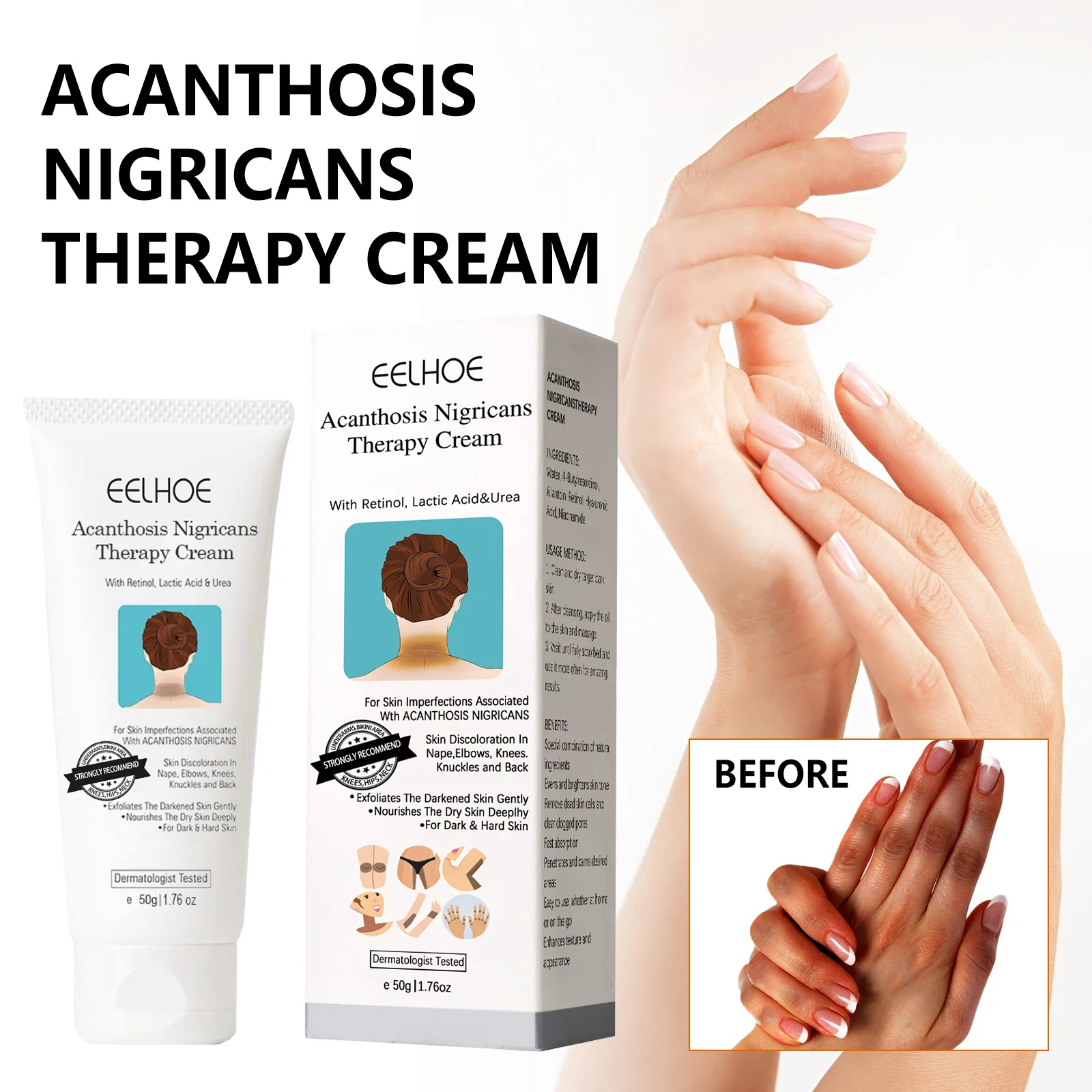 EELHOE Whitening Cream – Brightening for Dark Skin, Neck, Underarm & Body Care