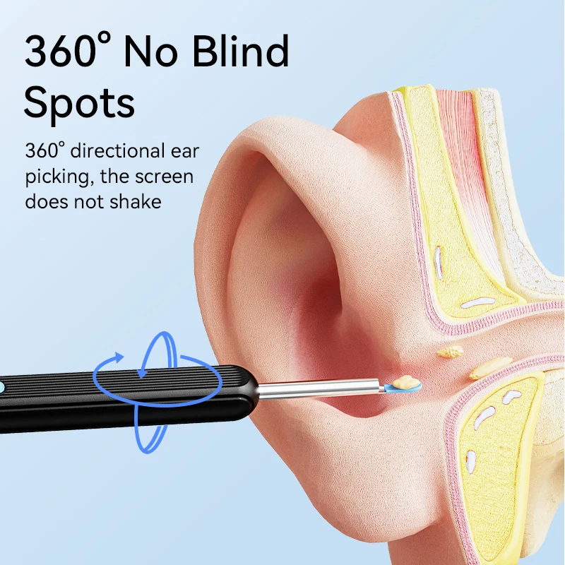 1296P HD Ear Wax Removal Kit with Camera & 6 LED Lights - Image 4