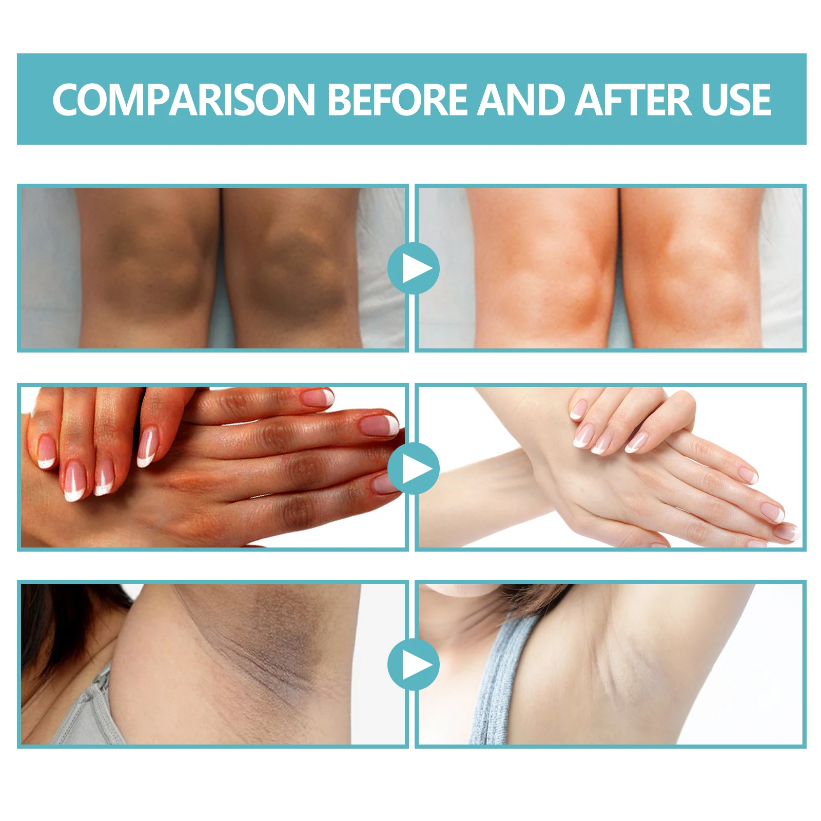 EELHOE Whitening Cream – Brightening for Dark Skin, Neck, Underarm & Body Care - Image 5